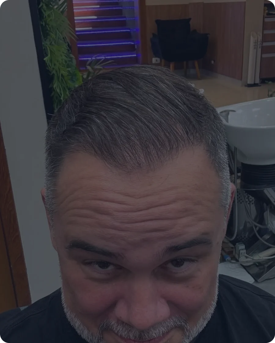 Resultado final